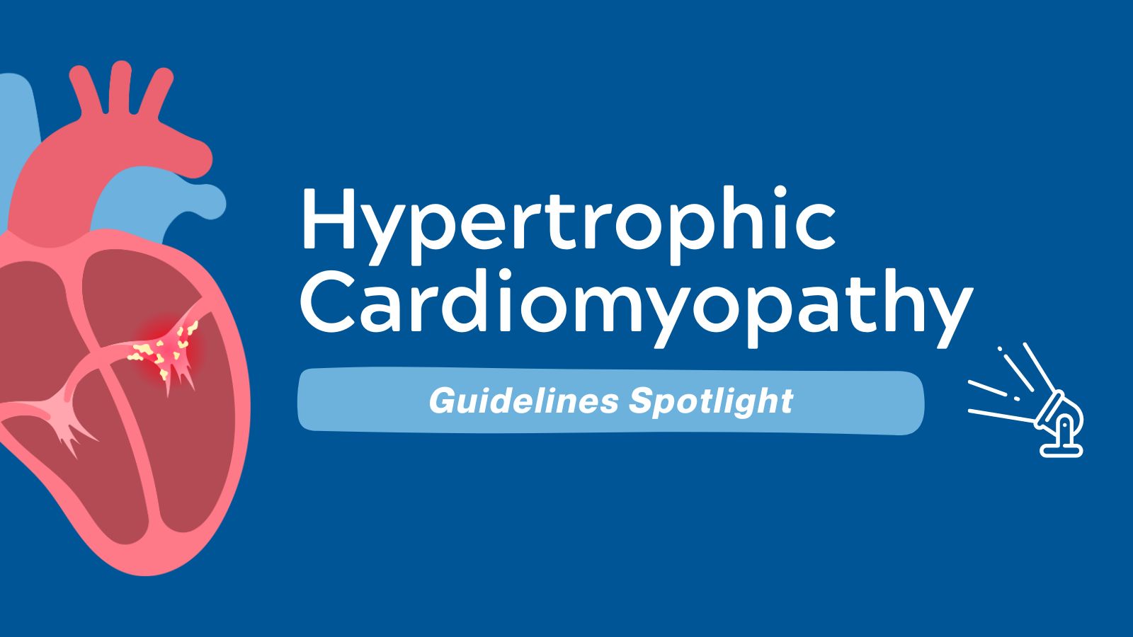 Guidelines Spotlight ACCAHA Hypertrophic Cardiomyopathy (HCM)