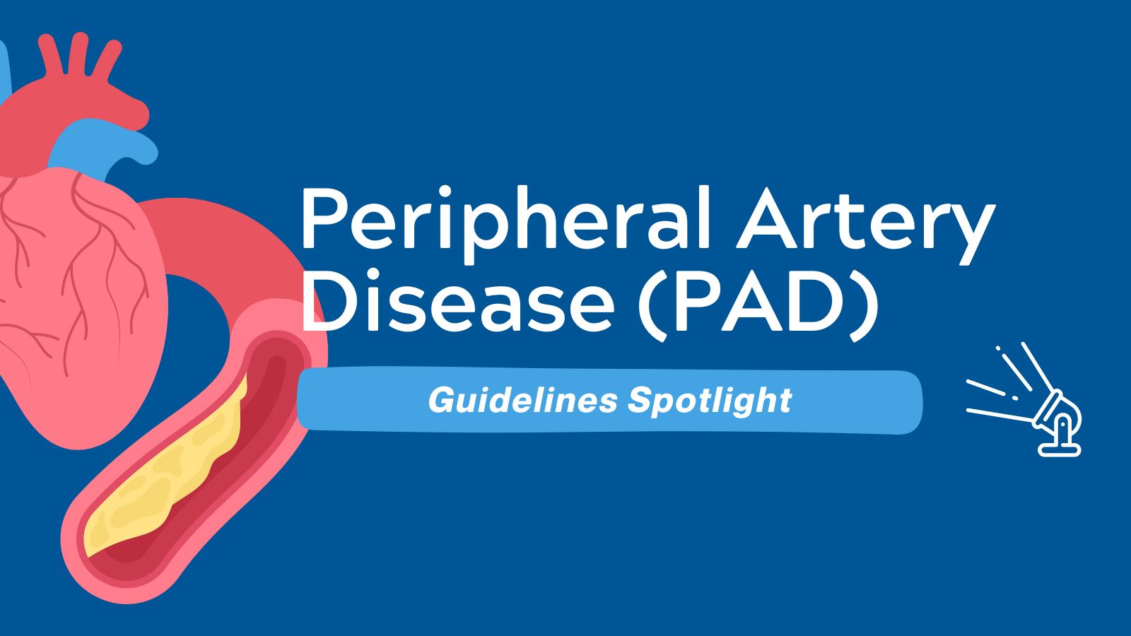 Guidelines Spotlight ACCAHA Peripheral Artery Disease (PAD)
