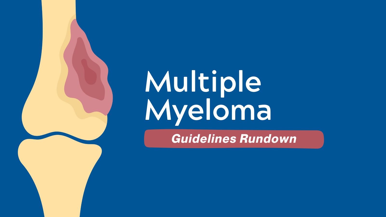Guidelines Rundown Multiple Myeloma
