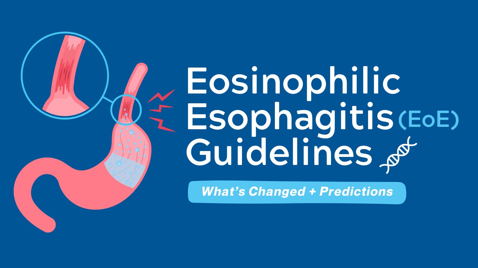 What's Changed & Predictions Eosinophilic Esophagitis (EoE)