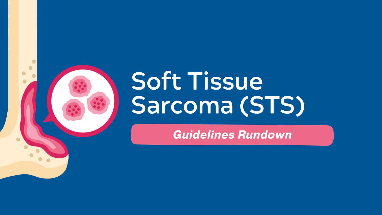 Guidelines Rundown - Soft Tissue Sarcoma (STS)