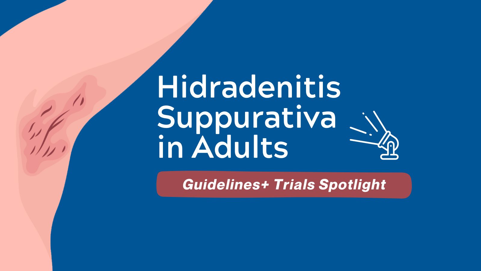 Guidelines+ Trials Spotlight - Hidradenitis Suppurativa