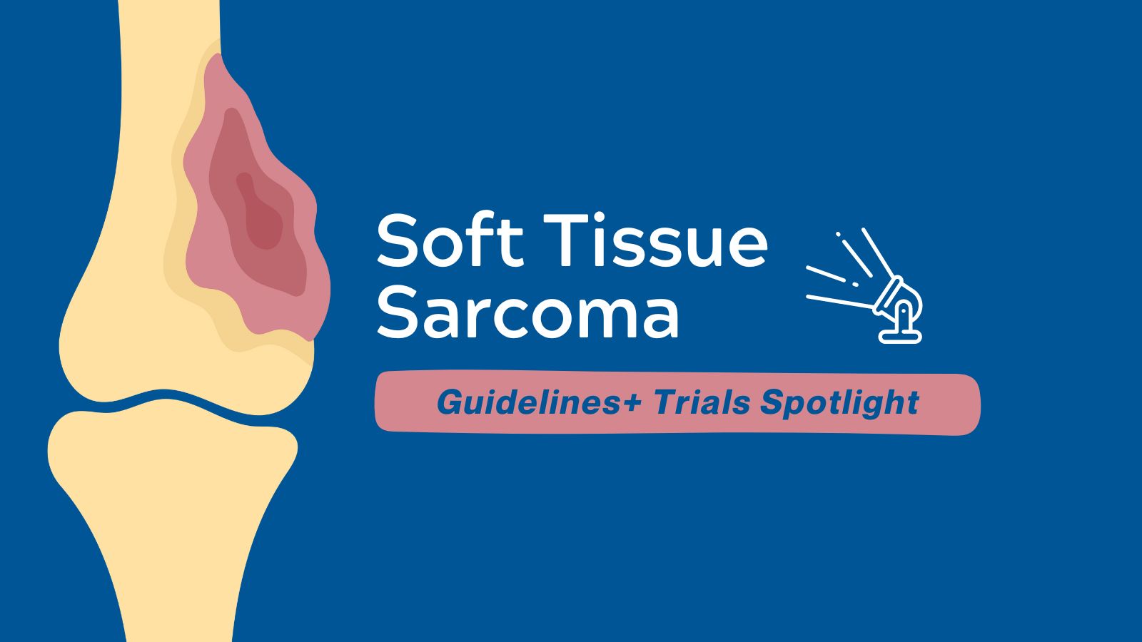 Guidelines+ Trials Spotlight - Soft Tissue Sarcoma