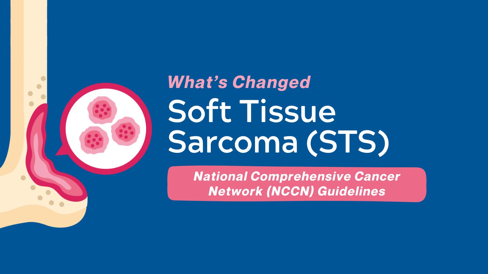 What's Changed - NCCN Soft Tissue Sarcoma (STS)