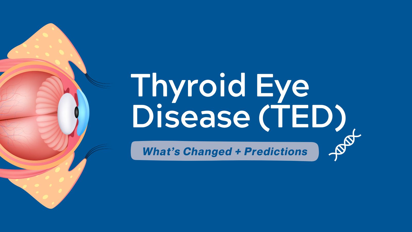 What's Changed & Predictions Thyroid Eye Disease (TED)