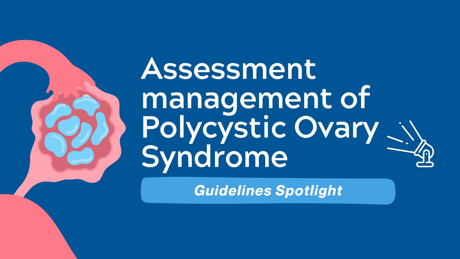 Guidelines Spotlight Assessment management of POCS