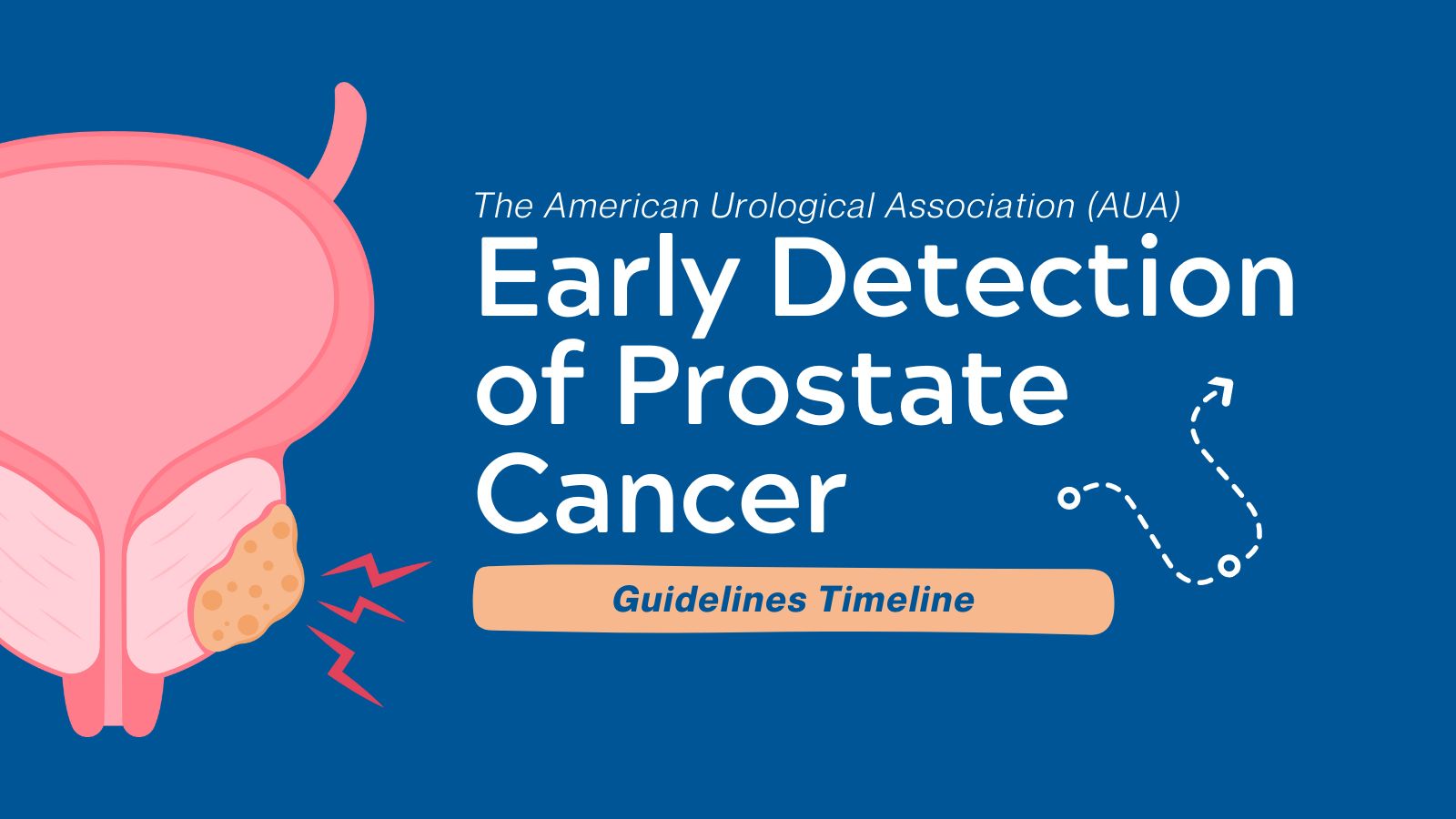 Guidelines Timeline - AUA Early Detection of Prostate Cancer