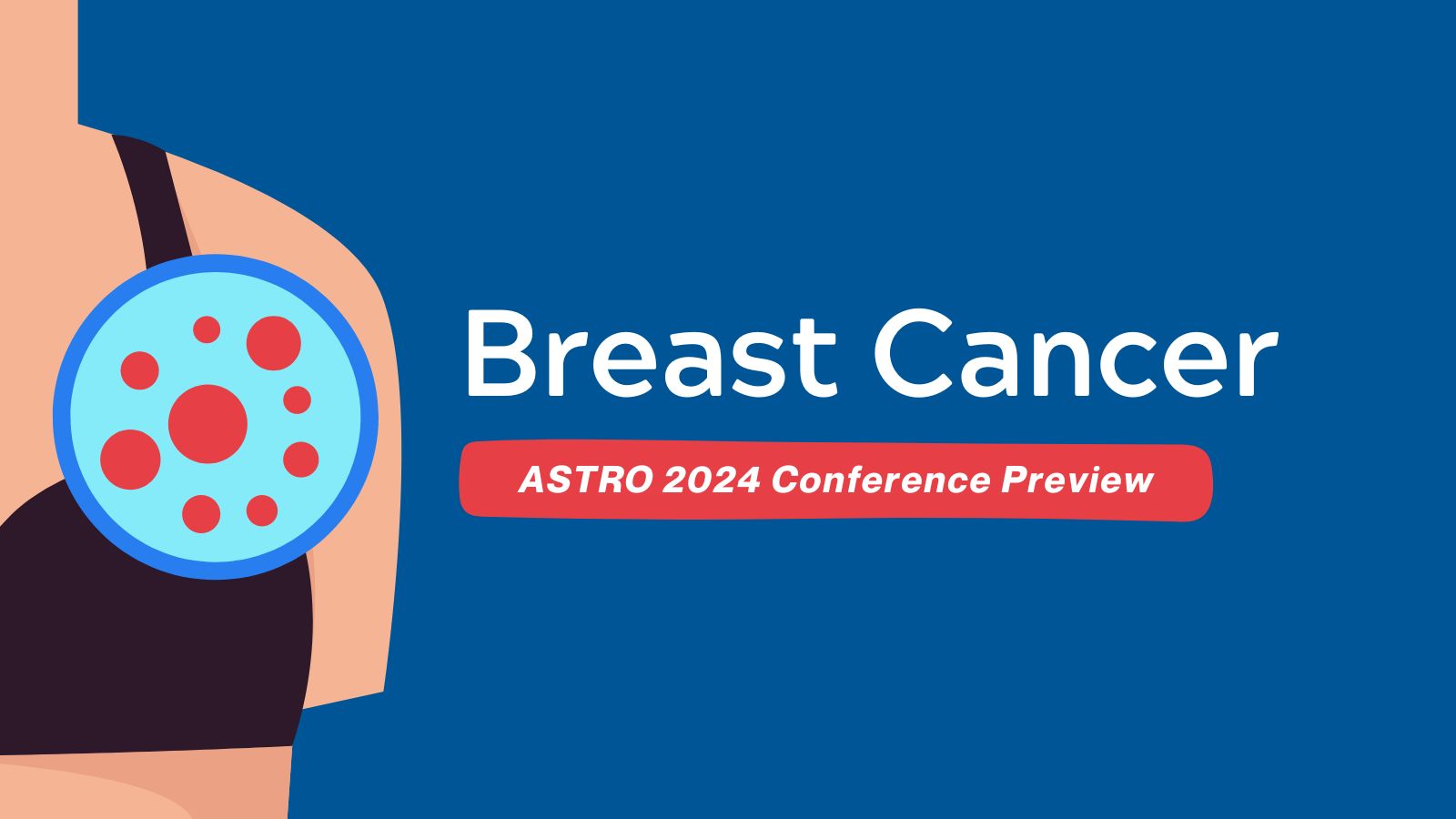 ASTRO 2024 Conference Preview - Breast Cancer