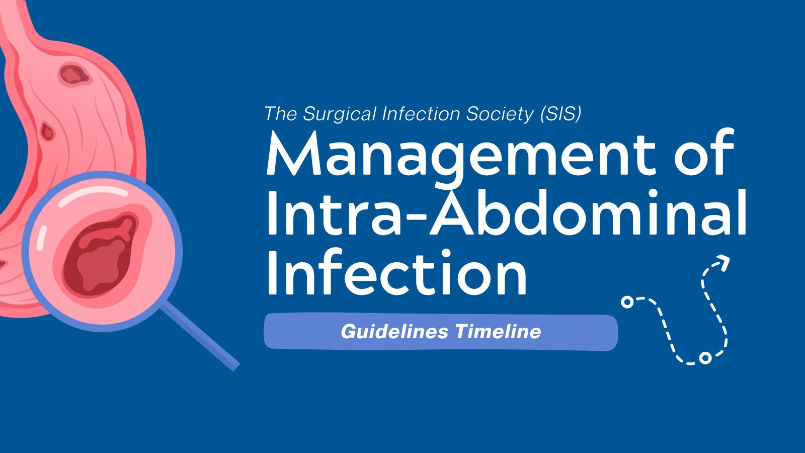 Guidelines Timeline - SIS Management of Intra-Abdominal Infection