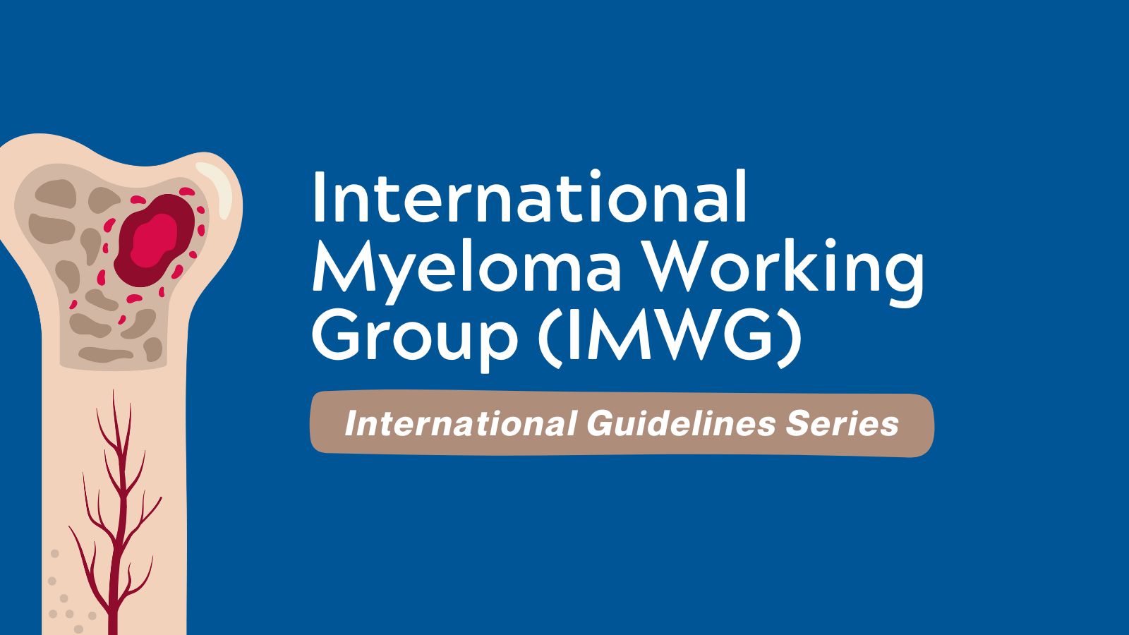 Int'l Guidelines - International Myeloma Working Group (IMWG)