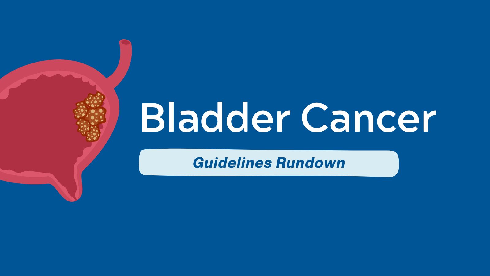 Guidelines Rundown - Bladder Cancer