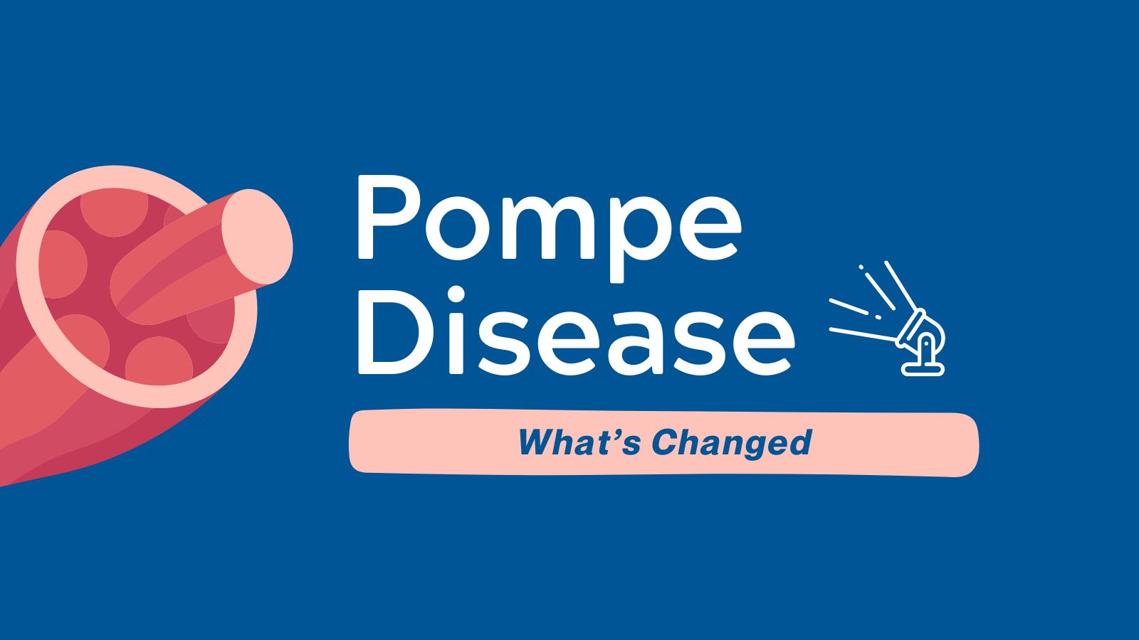 What's Changed Pompe Disease