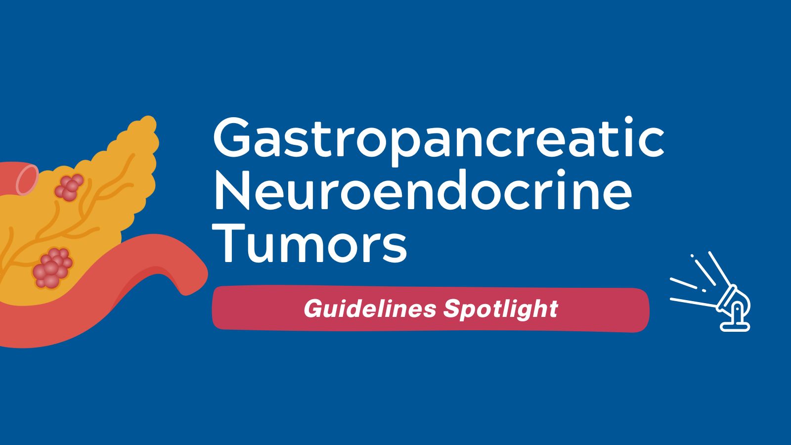 Guidelines Spotlight Gastropancreatic Neuroendocrine Tumors