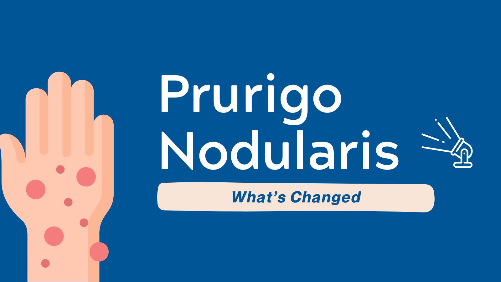 What's Changed Prurigo Nodularis