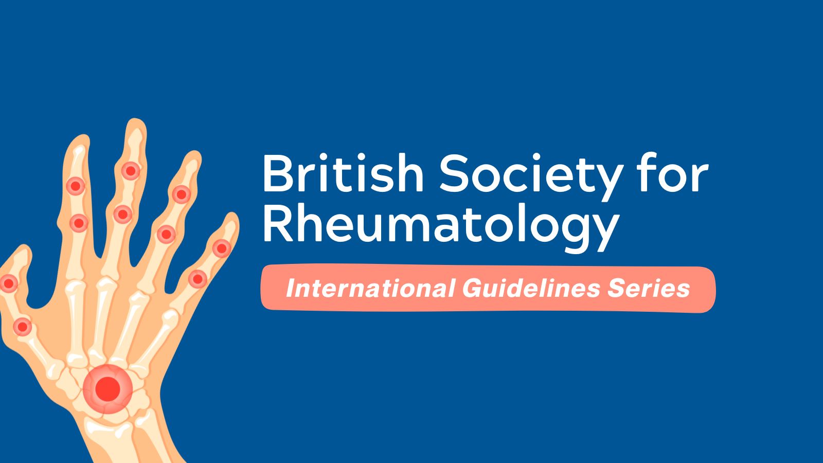 British Society for Rheumatology Int'l Guidelines