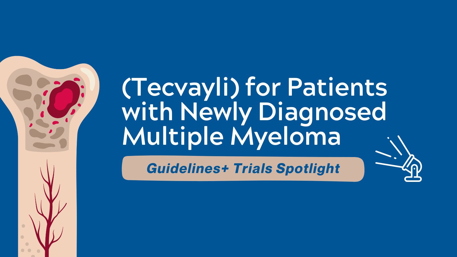 Guidelines+ Trials Spotlight - (Tecvayli) for Patients with Newly Diagnosed Multiple Myeloma