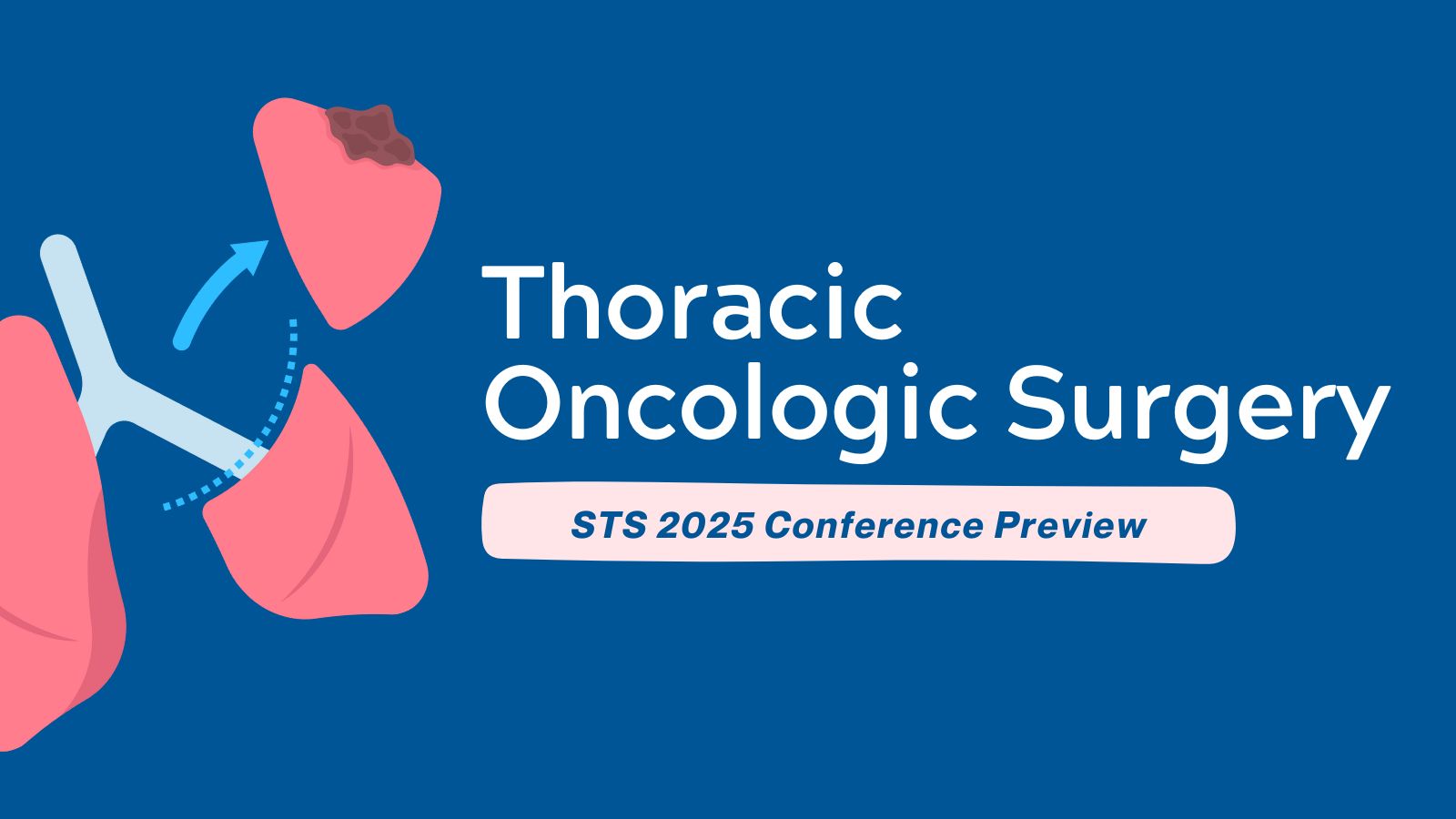 Thoracic Oncologic Surgery - STS 2025 - Conference Preview